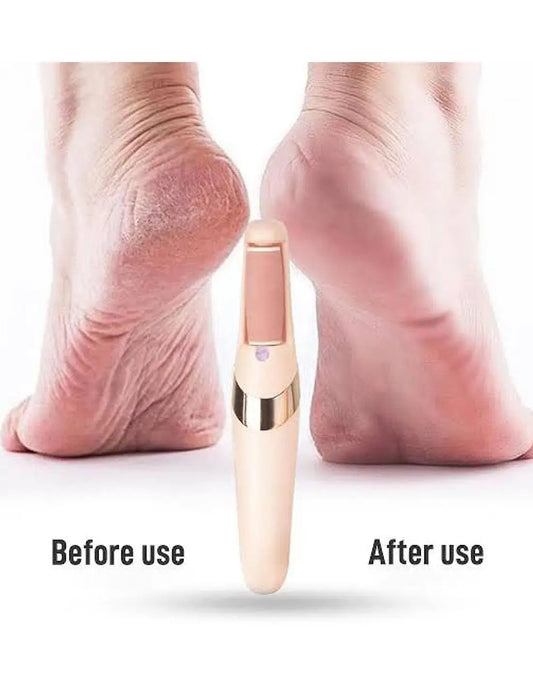 Rechargeable Electric Pedi Foot Filer – Effective Callus Remover for Soft, Smooth Feet