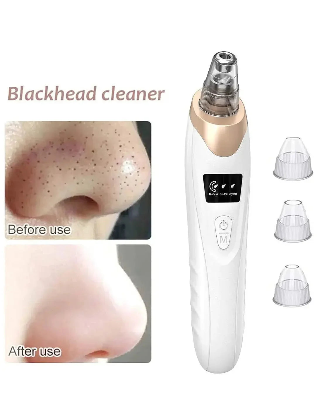 USB Rechargeable Blackhead Remover & Derma Suction Facial Cleansing Device