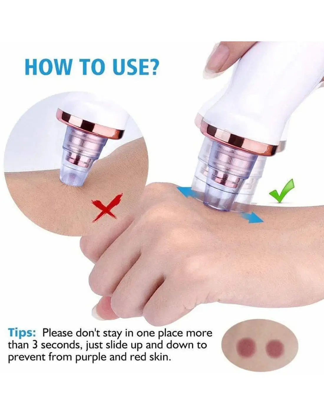 USB Rechargeable Blackhead Remover & Derma Suction Facial Cleansing Device