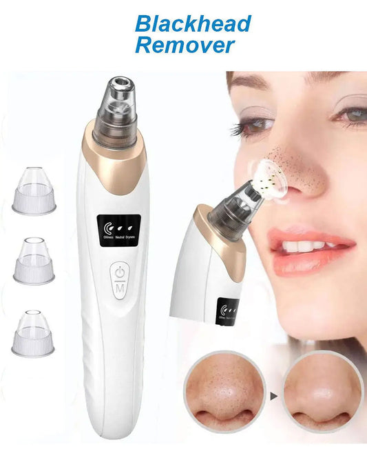 USB Rechargeable Blackhead Remover & Derma Suction Facial Cleansing Device